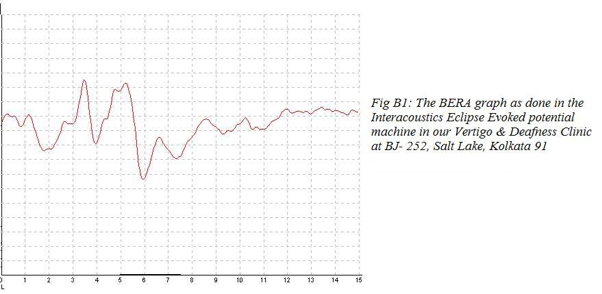 Bera Graph