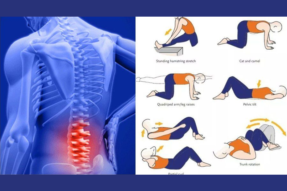 Back pain